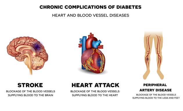 link between diabetes & heart attack